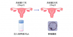 在哪里做试管婴儿便捷又靠谱？