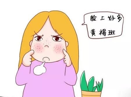 proxy.jpg 图片
